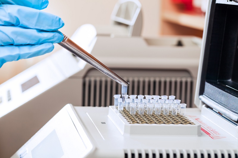 Xét nghiệm PCR đa mồi được đánh giá mang lại nhiều ưu điểm vượt trội so với các phương pháp truyền thống 