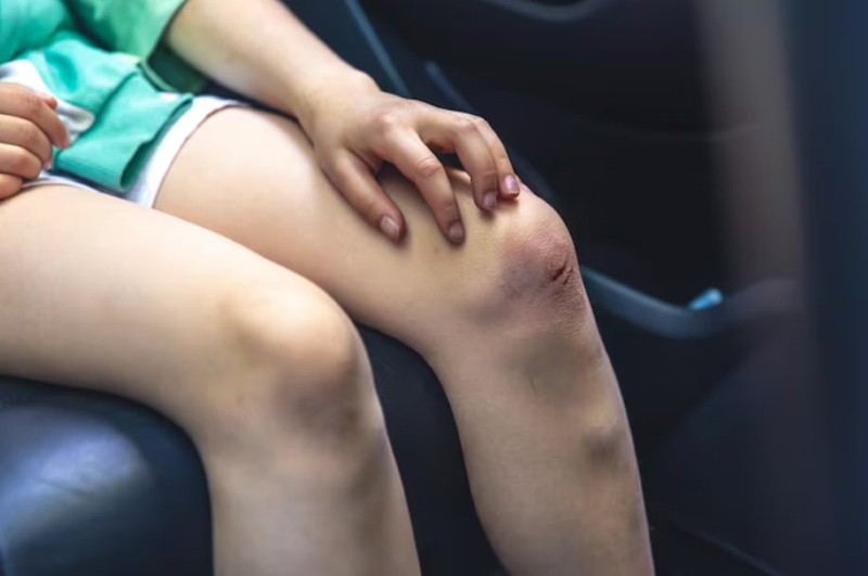 Tuyệt đối không dùng cây bòn bọt với vết thương hở