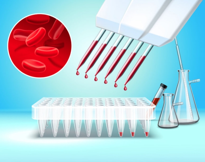Chỉ số LYM trong xét nghiệm máu tăng là dấu hiệu của các bệnh lý nhiễm khuẩn/virus 