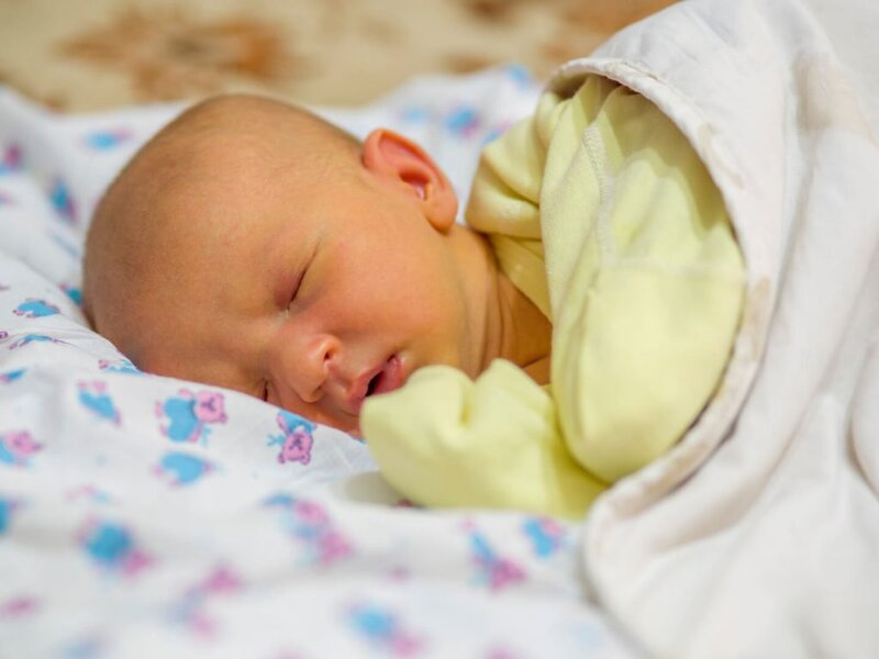 Những yếu tố gây ra vàng da ở em bé là gì?
