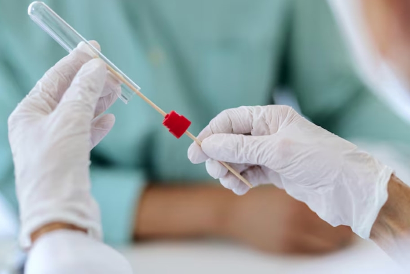 Thời gian trả kết quả xét nghiệm HPV phụ thuộc vào nhiều yếu tố