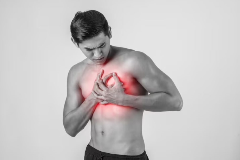 Cơn đau thắt ngực là triệu chứng điển hình nhất của hội chứng động mạch vành mạn
