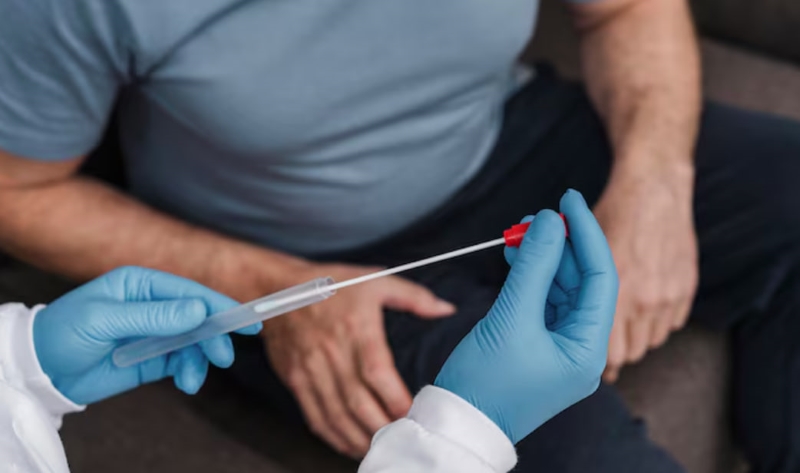 Việc phát hiện virus HPV ở nam giới có thể được thực hiện qua xét nghiệm DNA HPV với mẫu bệnh phẩm là tinh dịch hoặc dịch niệu đạo 
