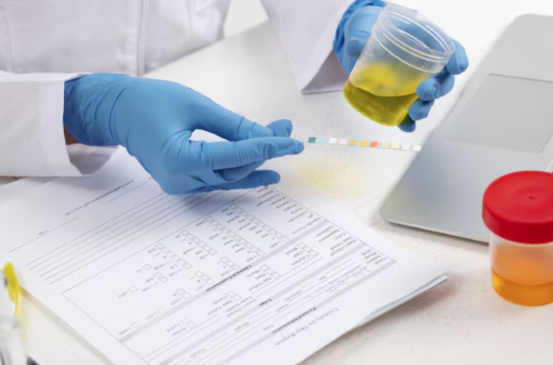 Xét nghiệm nước tiểu yêu cầu người thực hiện phải uống đủ nước để đảm bảo kết quả chính xác
