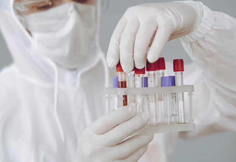 Xét nghiệm HBV-DNA được thực hiện với mục đích xác định nồng độ virus trong máu của người bệnh 