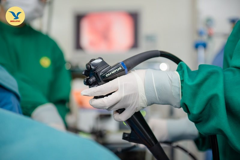 Nội soi lấy dị vật là phương pháp được ưu tiên trong giai đoạn đầu