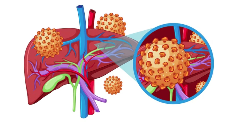 Ở giai đoạn cấp tính, cơ thể có khả năng tự đào thải virus viêm gan B