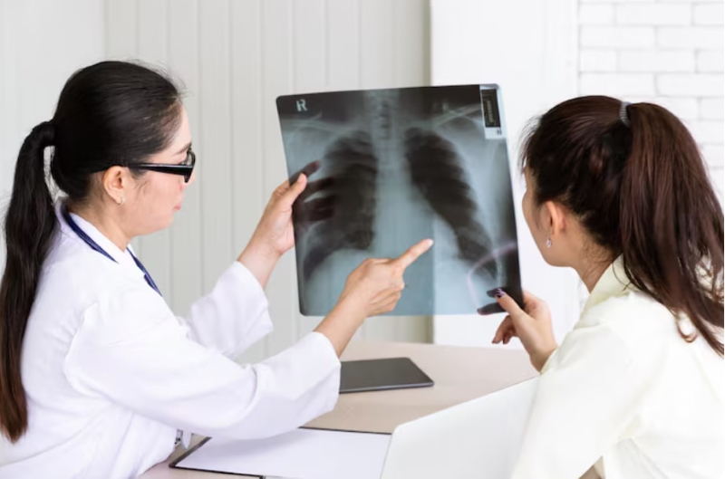 Việc phát hiện sớm và lựa chọn đúng phương pháp điều trị giúp cải thiện tiên lượng của người mắc u phổi ác tính