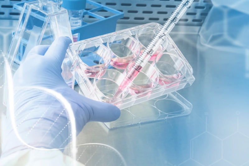 Xét nghiệm đột biến gen EGFR là một trong những xét nghiệm đột biến gen ung thư phổi phổ biến 