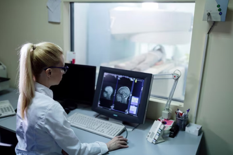 Chụp MRI sọ não giúp phát hiện sớm các bệnh lý tại não bộ