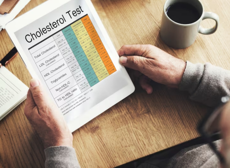 Chỉ số cholesterol toàn phần có mối liên quan trực tiếp tới sức khỏe tim mạch 