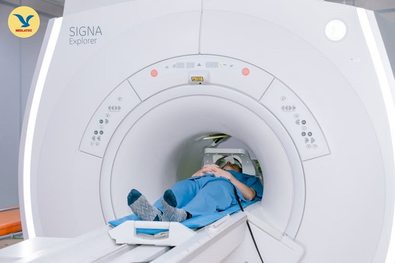Chụp MRI giúp đánh giá chính xác phạm vi tổn thương não