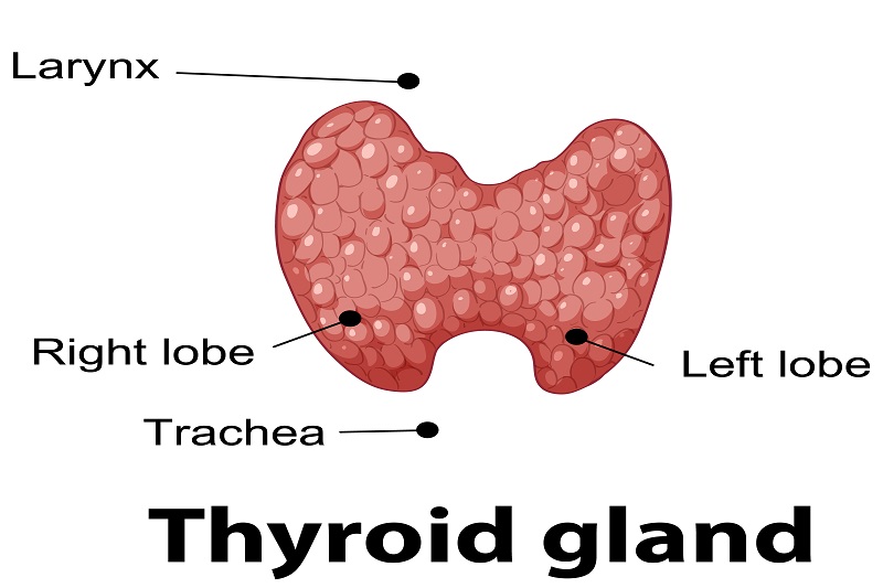 Số ít trường hợp ung thư tuyến giáp có thể gây viêm hạch bạch huyết ở cổ