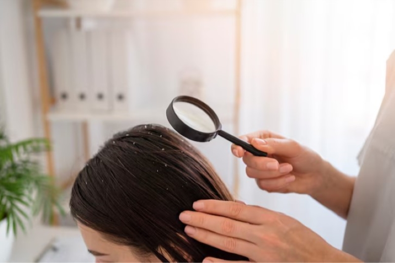 Thăm khám kịp thời nếu tình trạng nấm da đầu không có dấu hiệu cải thiện