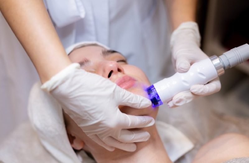 Kỹ thuật laser vi điểm là phương pháp điều trị sẹo đáy nhọn mang lại hiệu quả
