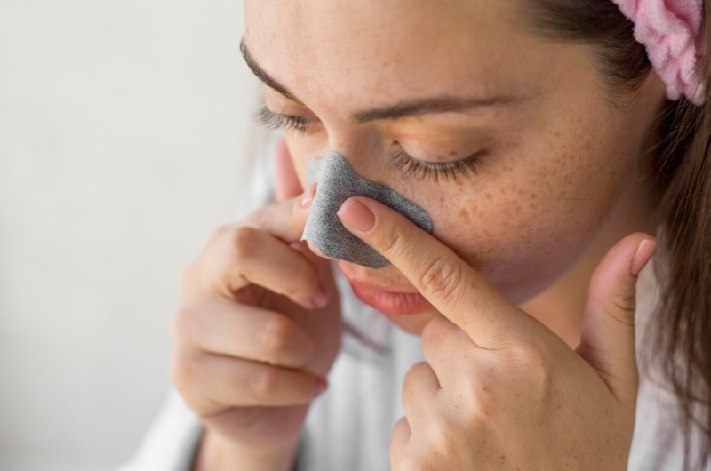 Mụn đầu đen là một trong các loại mụn ở mặt phổ biến 