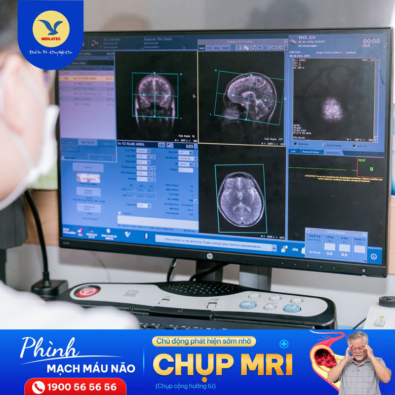 Chụp cộng hưởng từ não cần nhiều thời gian phân tích và tổng hợp hơn