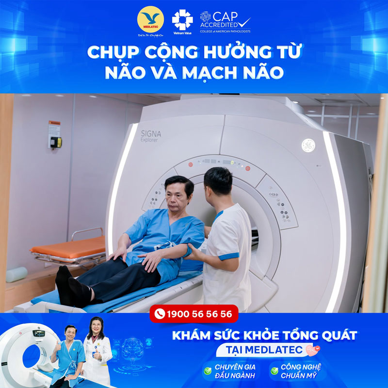 Những lưu ý giúp rút ngắn thời gian chụp cộng hưởng từ não