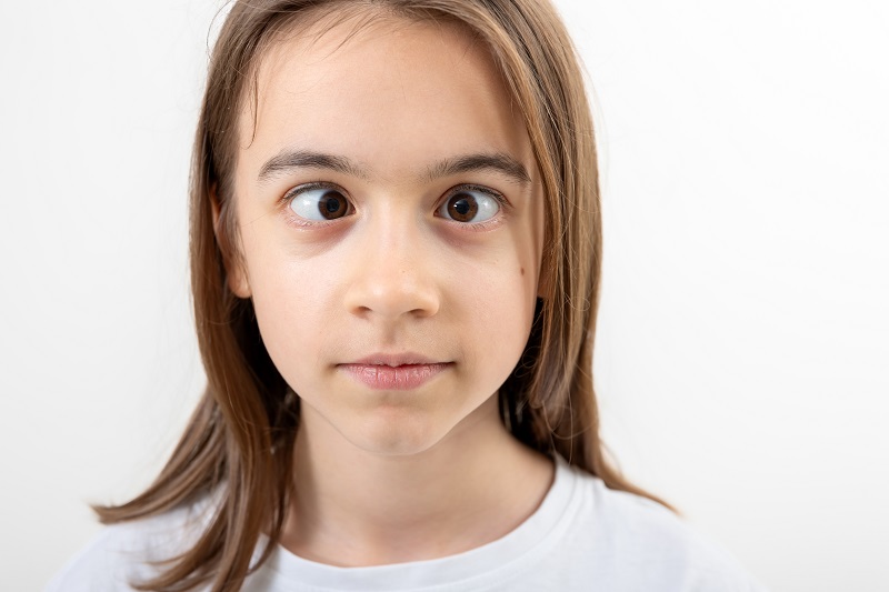 Hai mắt không nhìn được cùng một hướng có thể là dấu hiệu bé bị lác mắt