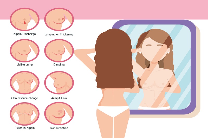 Hình ảnh mô phỏng cách tự kiểm tra tuyến vú tại nhà