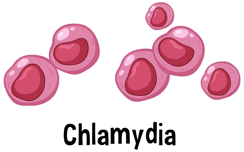 Dịch âm đạo màu vàng có thể do nhiễm Chlamydia