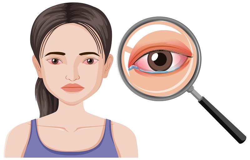 Thời gian hồi phục sau cắt mộng mắt ở mỗi bệnh nhân không giống nhau