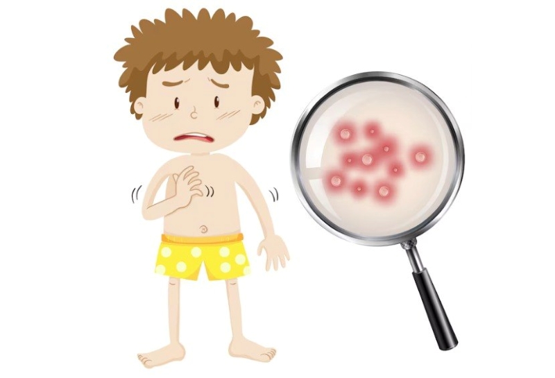 <a href='https://medlatec.vn/tu-dien-benh-ly/thuy-dau-scVIe' title='Thủy đậu'>Thủy đậu</a> có khả năng lây lan nhanh chóng