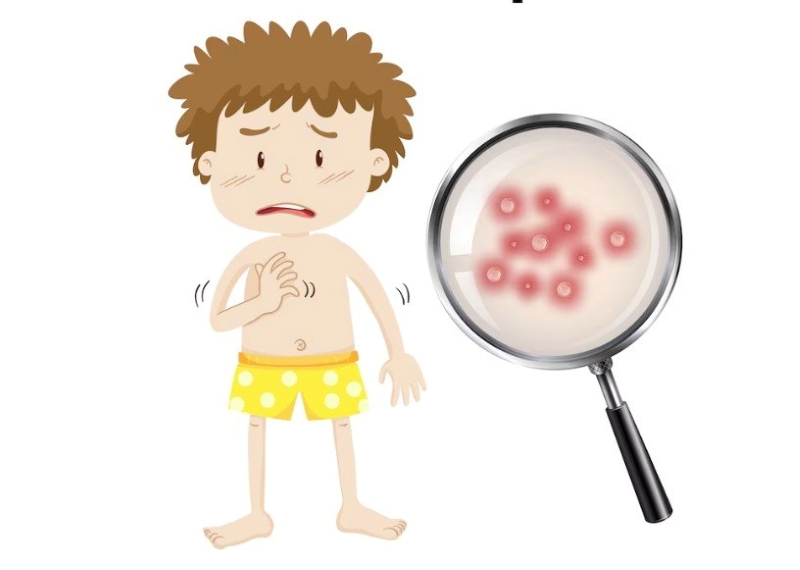 Thủy đậu có nguy cơ gây ra những biến chứng nguy hiểm đối với sức khỏe của trẻ 
