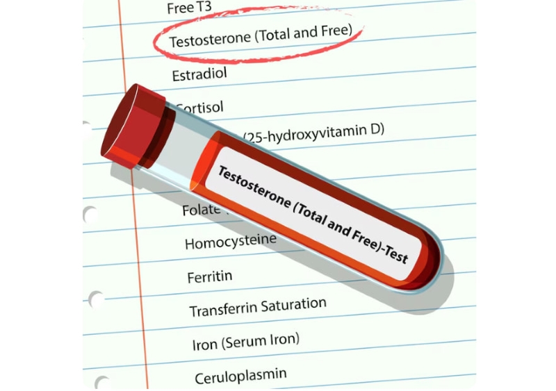 Chỉ số testosterone nmol/l giúp đánh giá sức khỏe sinh sản ở nam giới 