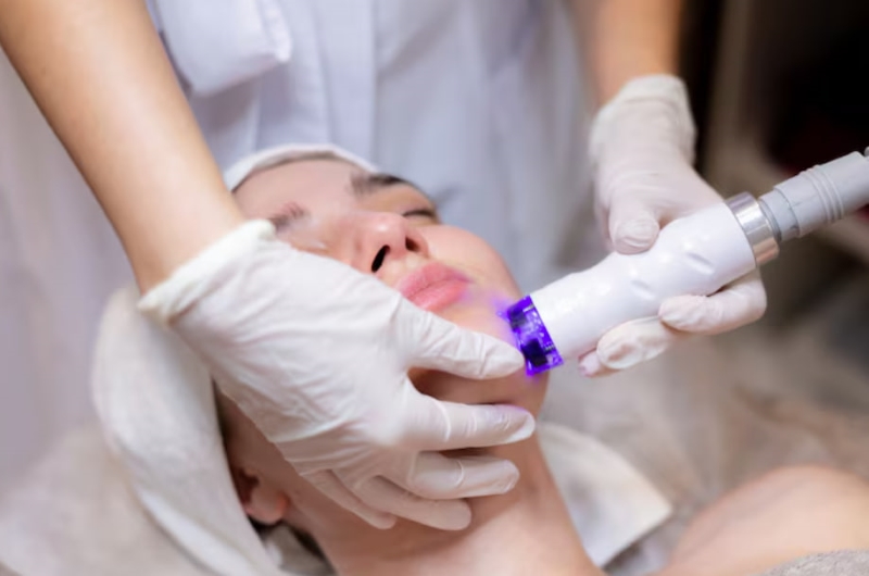 Liệu pháp laser được ứng dụng trong điều trị tình trạng giãn mao mạch 