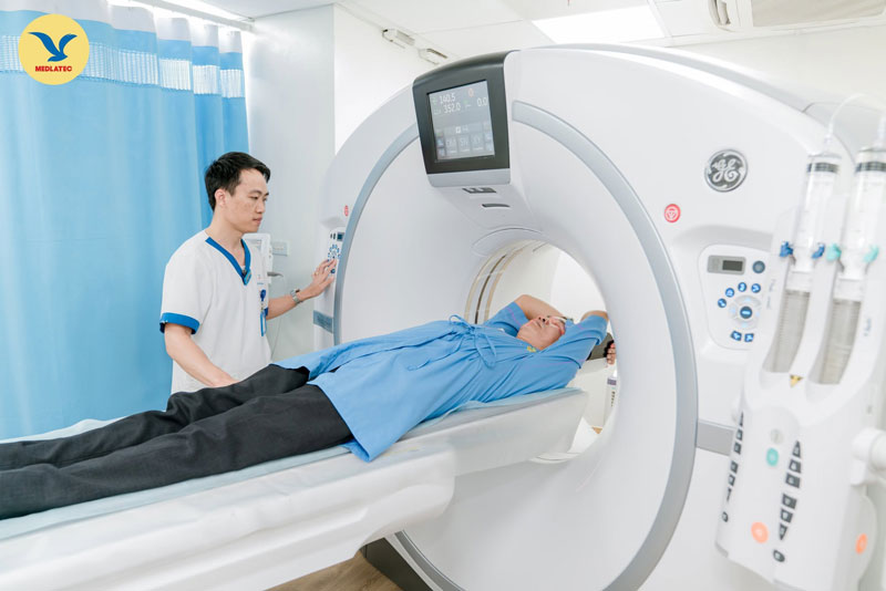 Khoảng cách giữa 2 lần chụp CT sẽ phụ thuộc vào các trường hợp khác nhau