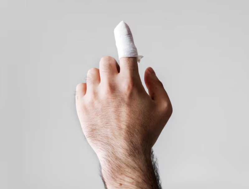HIV có lây qua vết xước nhỏ không còn phụ thuộc vào tính chất của vết xước 