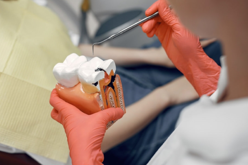 Với độ an toàn cao và khả năng phục hồi tốt, trám răng là lựa chọn phù hợp trong điều trị các trường hợp răng sâu