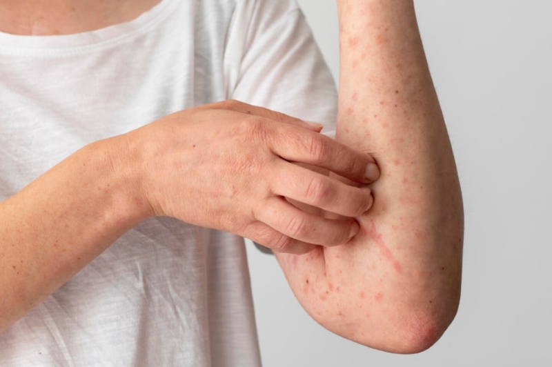Người dân nên thực hiện xét nghiệm giun sán nếu xuất hiện các triệu chứng nghi ngờ 