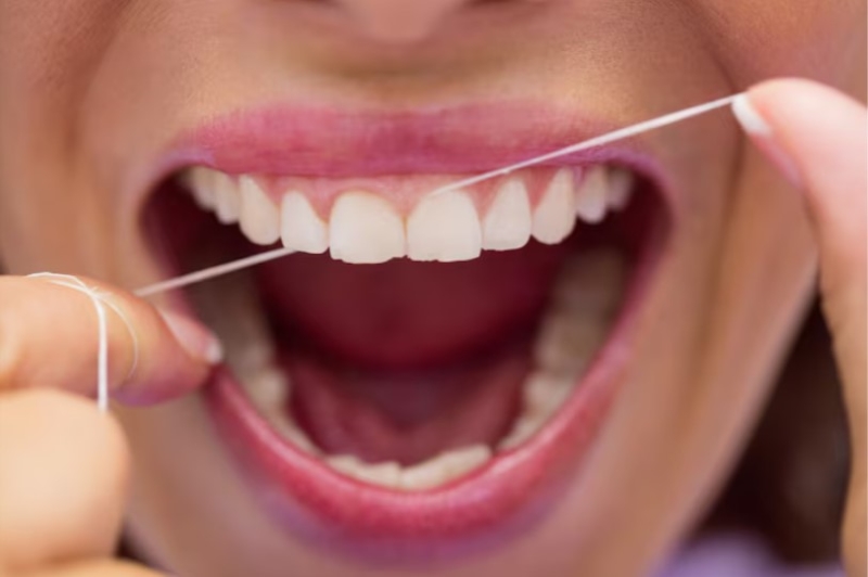 Sử dụng chỉ nha khoa hoặc tăm nước để hỗ trợ quá trình vệ sinh răng miệng
