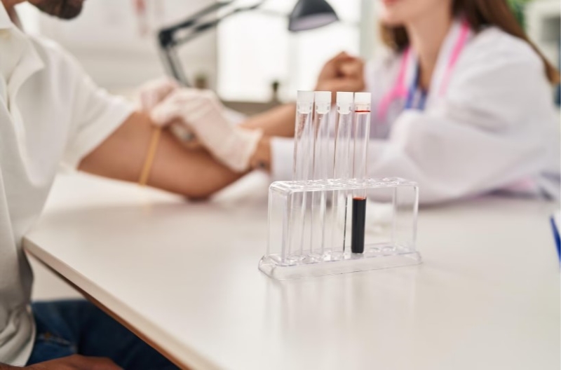 Creatinine huyết thanh là một trong những chỉ số xét nghiệm suy thận quan trọng 