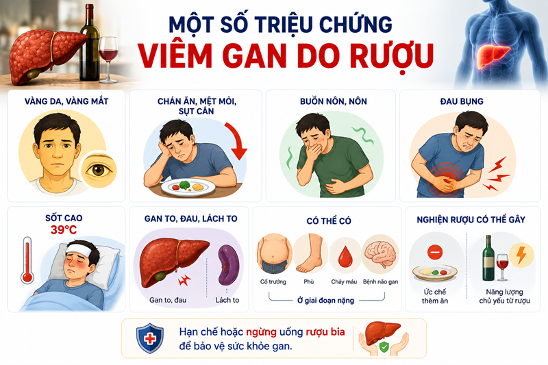 Các triệu chứng thường gặp của viêm gan do rượu người dân nên cảnh giác. Hình minh họa, nguồn AI