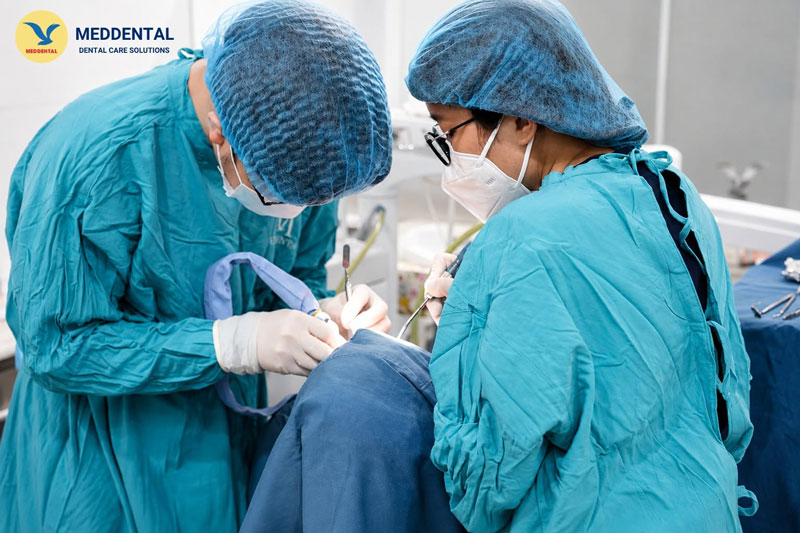 Nhổ răng khôn có ảnh hưởng đến thần kinh không là câu hỏi khiến nhiều người băn khoăn
