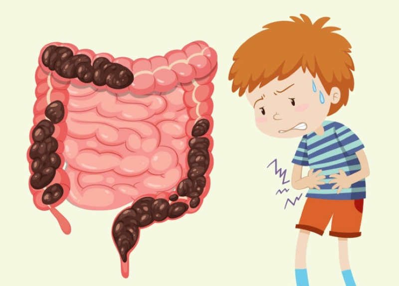 Dị tật bẩm sinh có thể là nguyên nhân gây ra tình trạng xoắn ruột ở trẻ