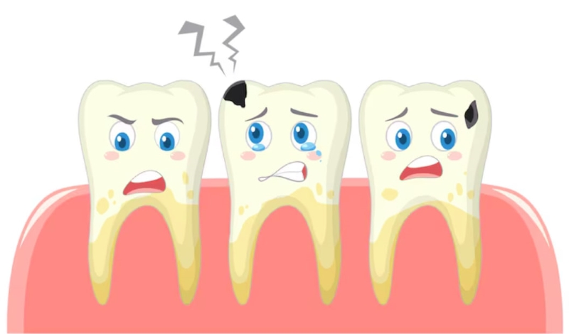 Có nhiều nguyên nhân khiến tủy răng bị tổn thương