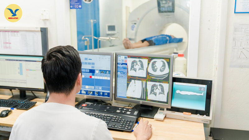 Trường hợp có các bất thường, bác sĩ thường sẽ chỉ định kết hợp thêm các phương pháp chẩn đoán khác ngoài X-quang phổi