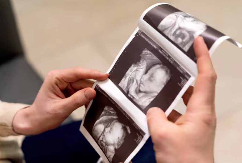 Siêu âm 5D cho ra hình ảnh rõ nét, chất lượng 