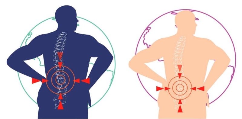 Thoái hóa cột sống thắt lưng gây tổn thương cấu trúc cột sống, dẫn đến đau và khó khăn khi vận động