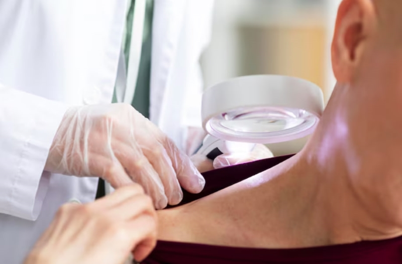 Chủ động thăm khám và điều trị sớm để hạn chế biến chứng do zona thần kinh gây ra 