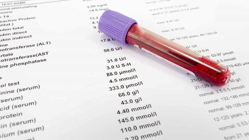 Xét nghiệm bilirubin toàn phần có ý nghĩa gì trong chuẩn đoán bệnh gan?