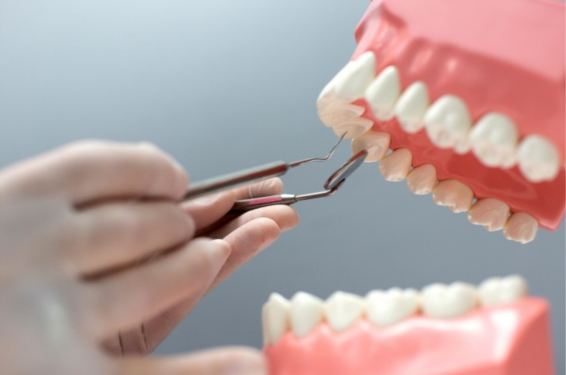 Trồng răng sứ giá bao nhiêu – chi phí phụ thuộc vào nhiều yếu tố