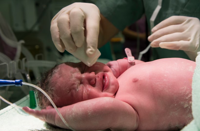 Apgar là chỉ số có vai trò quan trọng đối với sức khỏe của trẻ sơ sinh