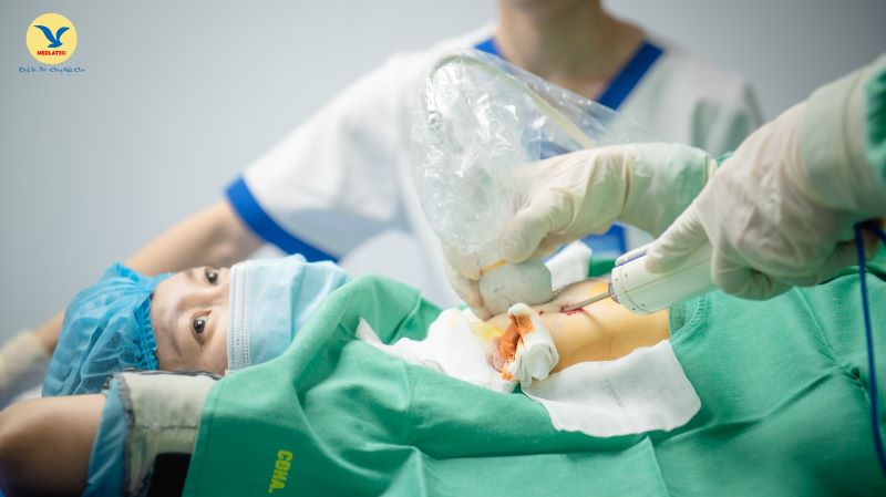 Người bệnh đang thực hiện sinh thiết vú bằng phương pháp hút chân không (VABB) tại Hệ thống Y tế MEDLATEC
