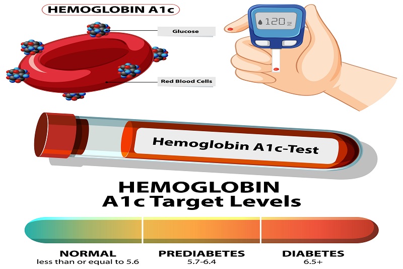 Xét nghiệm Hemoglobin giúp xác định chỉ số huyết sắc tố, đánh giá nguy cơ thiếu máu