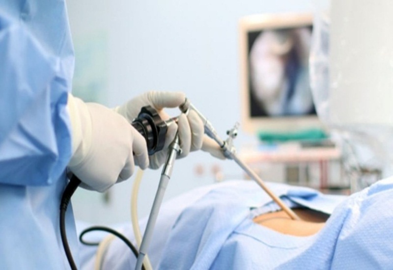 Phương pháp phẫu thuật nội soi ổ bụng ảnh hưởng như thế nào đến quá trình phục hồi của bệnh nhân? 
